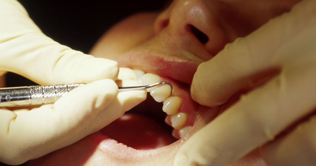 Frontline teeth shop cleaner