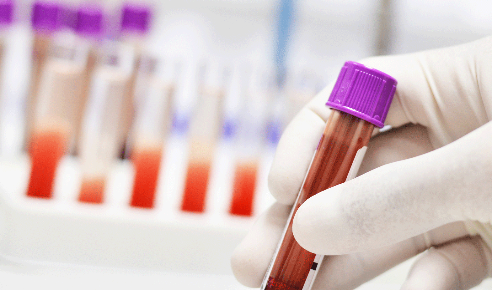 blood samples in a lab