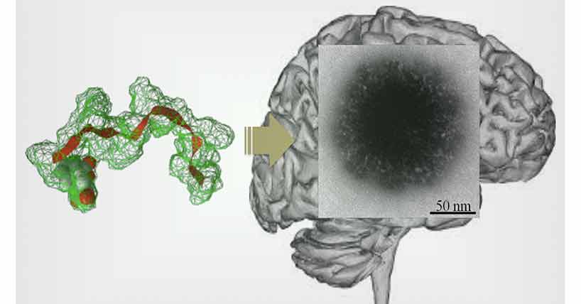 Self-assembly of a peptide to ‘hairy-like particles’ that target the brain on intravenous injection