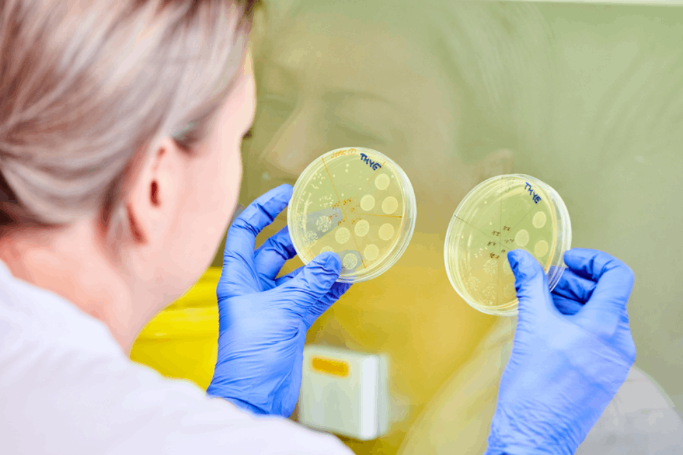 lab technician working with two petri dishes